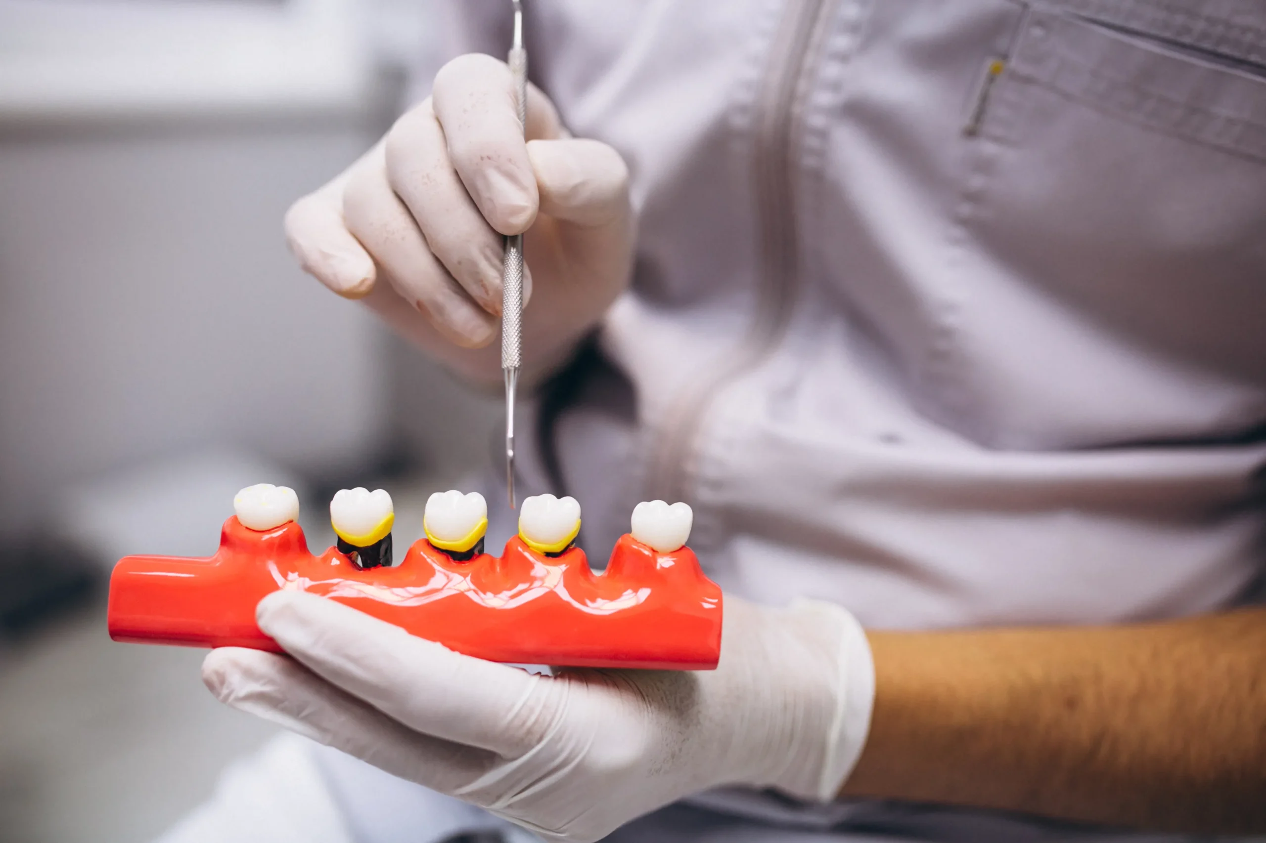 implant fiyat 01