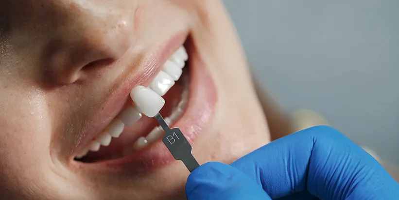 implant fiyat 03